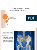 Artroplastia de Cadera Thompson y Bipolar