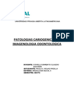 Patologias Cariogenicas