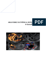 Gravidezectopicaintersticial PDF