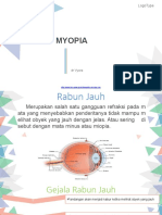 myopia - Copy