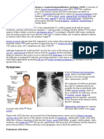 Acquired immune deficiency syndrome or acquired immunodeficiency syndrome