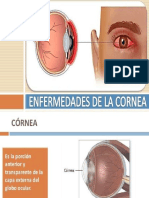 Úlcera corneal: causas, síntomas y tratamiento