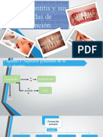 La Periodontitis y sus medidas de prevención.pptx