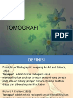 Tomografi