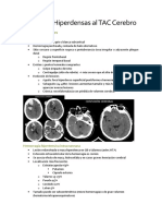 Lesiones Hiperdensas Al TAC Cerebro