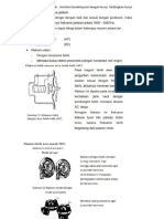 Klakson Dan Relay