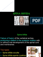 Spina Bifida