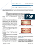 The Treatment Strategy of An Oblique Complicated Crownroot Fracturecase Report PDC 1000110