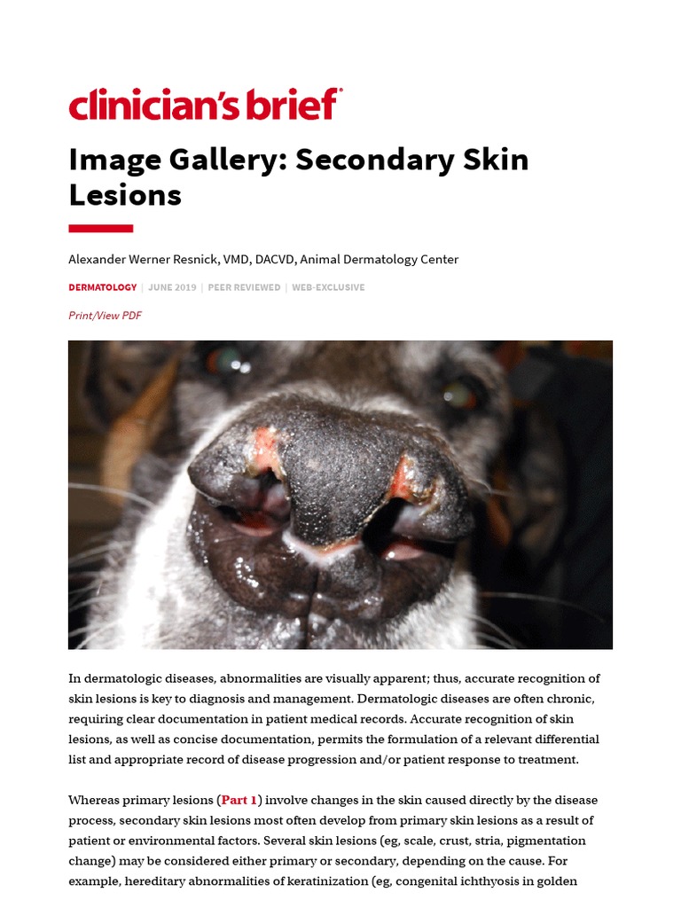 Image Gallery Secondary Skin Lesions Clinicians Brief Pdf Skin