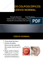 aspectos colposcopicos del cervix normal + ectopia.pptx