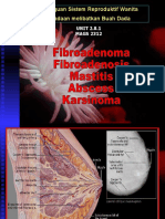 Fibroadenoma Mastitis Abscess Karsinoma Breast