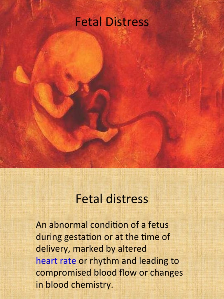 Fetal Distress PDF