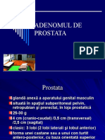Adenomul de prostata 