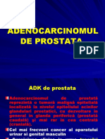 Adenocarcinomul de prostata