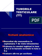 Tumorile Testiculare