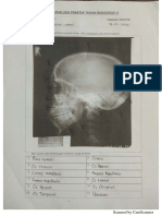 1D TR2 Cranium