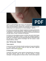 Tinha É o Nome Genérico Que Se Dá A Uma Dermatofitose