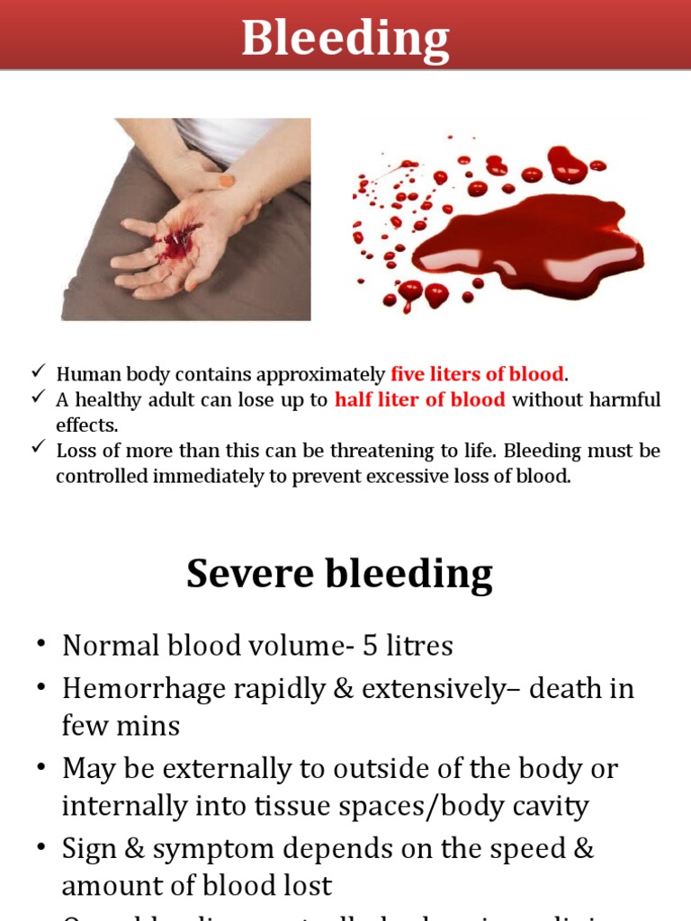 Control Bleeding Shock Pdf Shock Circulatory Bleeding
