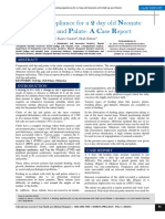 A Feeding Appliance For A 2 Day Old Neonate With Cleft Lip and Palate - A Case Report