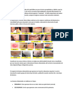 Lesiones en la piel_ dermatologia