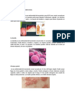 Infecciones de Transmision Sexual