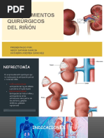 Procedimiento Colocacion y Retiro Cateter Doble J | PDF | Riñón ...