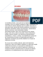 TX Mordida Abierta y Profunda