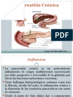 Pancreatitis