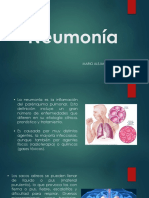 Presentacion de Neumonia (Mario Valdes) PDF
