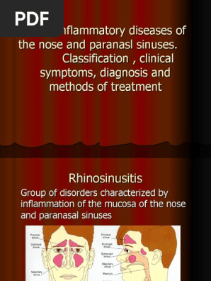 Sinusite 3 Human Nose Human Anatomy