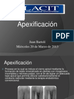 Apexificacin