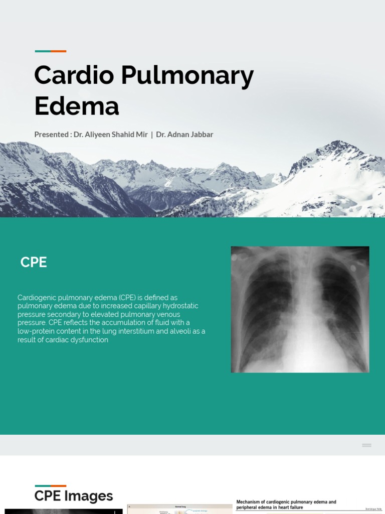 Cardio Pulmonary Edema | PDF | Heart Failure | Myocardial Infarction