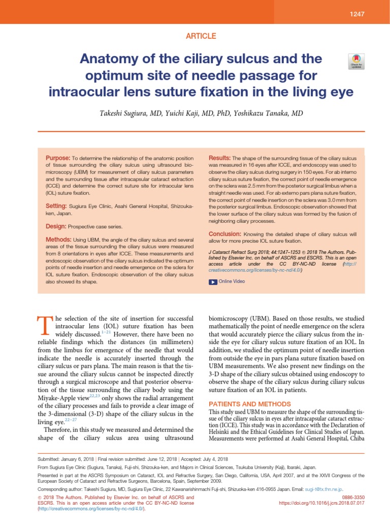 Ciliary Sulcus Anatomy for IOL Fixation | PDF | Ophthalmology ...