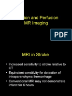 MRI in Stroke: Diffusion and Perfusion Imaging