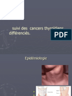 Présentation Cancer Thyroidien