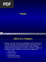 Tumor OITE - 2012 2013 2014