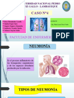 Diapositivas de Neumonia 2019..