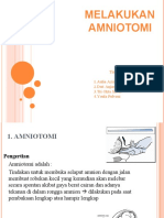 Amniotomi
