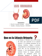 Litiasis Renal