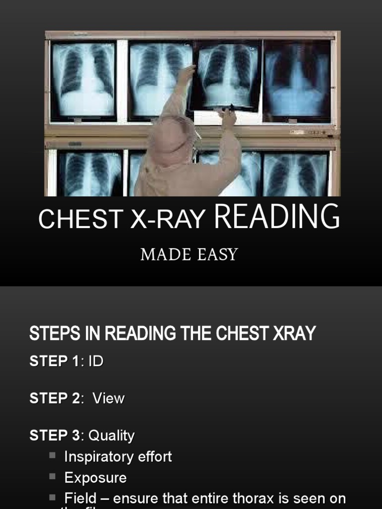 CXR Reading Made Easy | PDF | Lung | Atrium (Heart)