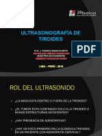 Ultrasonografía de la tiroides: diagnóstico de alteraciones
