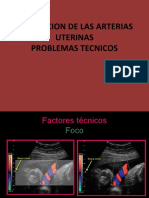 Evaluacion de Las Arterias Uterinas