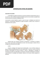artroplastia-total-quadril-orientacoes