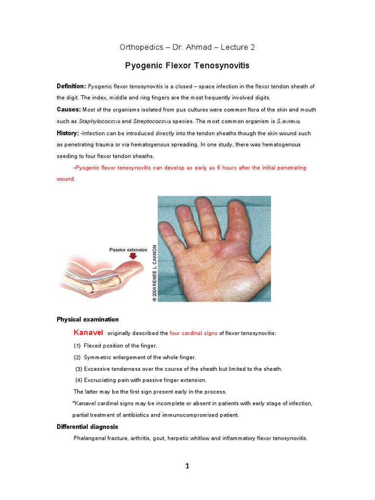 Pyogenic Flexor Tenosynovitis Overview | PDF | Herpes Simplex | Hand