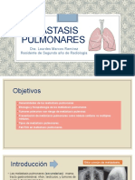 Metástasis Pulmonares
