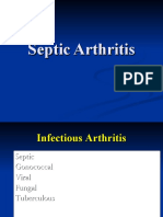 Septic Arthritis