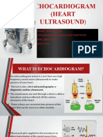 Echocardiogram (Heart Ultrasound) : Name:Fatema Ilyas Organization:Tabba Heart Institute ROLL NO:16-02 Batch:Vii