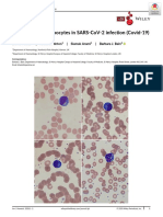 Foldes, D., Et Al. (2020) - Plasmacytoid Lymphocytes in SARS CoV 2 Infection (Covid 19) - American Journal of Hematology PDF