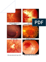 Labelled_Fundus_Pictures.pdf