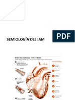 Semiologia de IAM